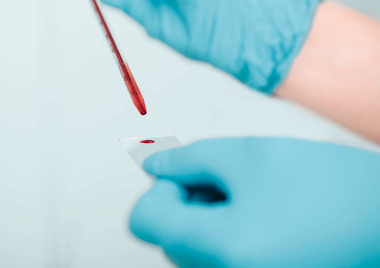 CDLS sul valore della donazione di sangue: “Un gesto prezioso e accessibile a tutti”